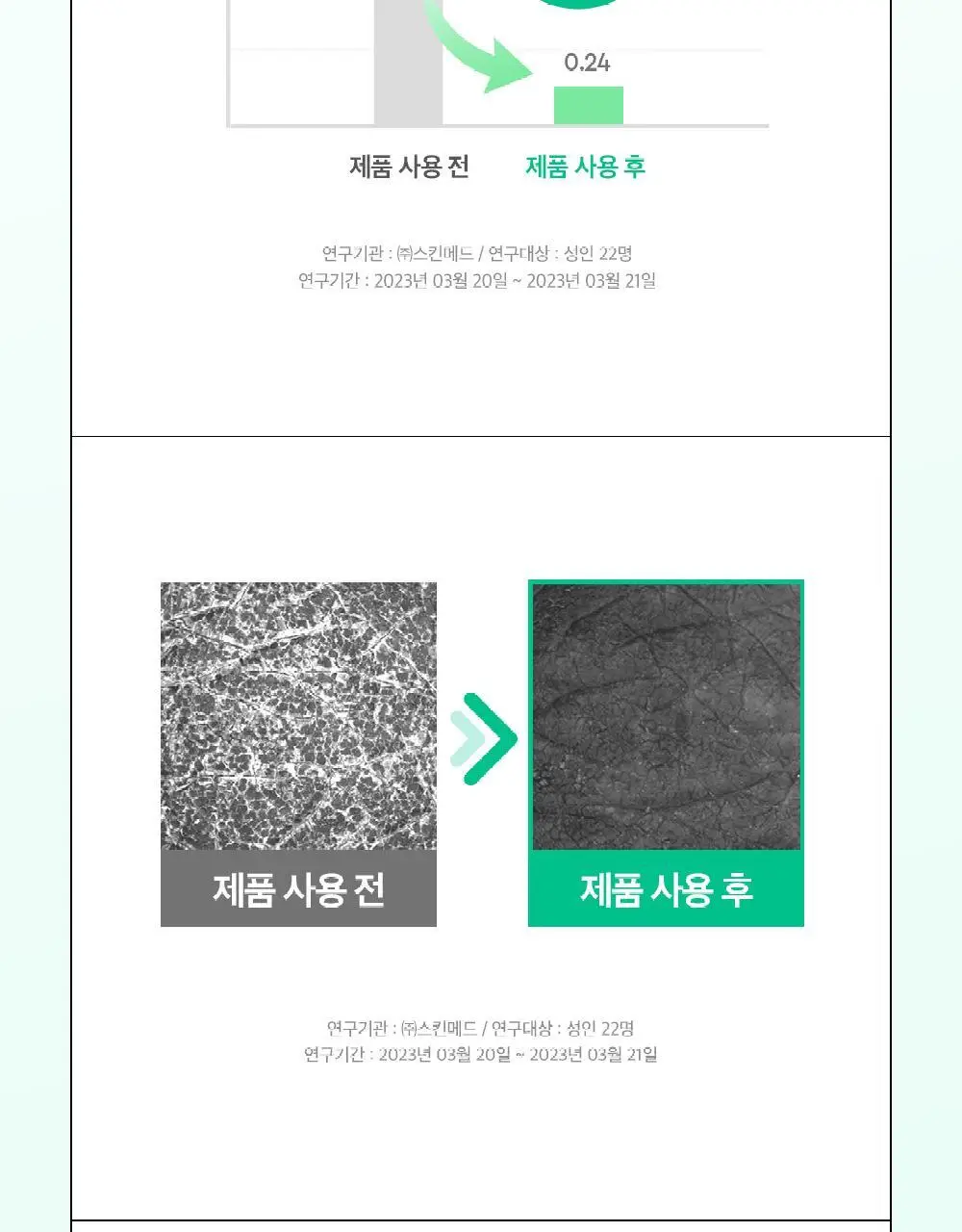 [각질/모공/피지] 듀이트리 AC컨트롤 딥 그린 카밍 클레이 젤 모공팩 100ml (기획/단품) 상세페이지 29
